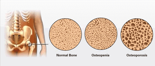 bone tissue, human body,  Osteoblasts, bones, human, osteocytes