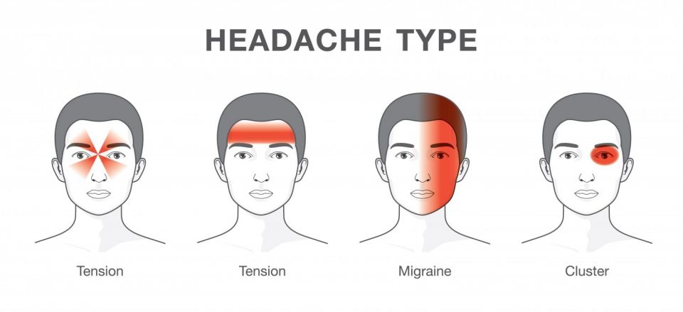 headaches, scientists, doctor, harmful headache, human body, types of headache, causes of headache, Causes of the Headaches considered powerful affections.