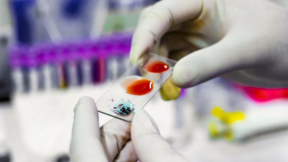 Blood, scientist, japan, tokyo, Blood Type Of A Patient