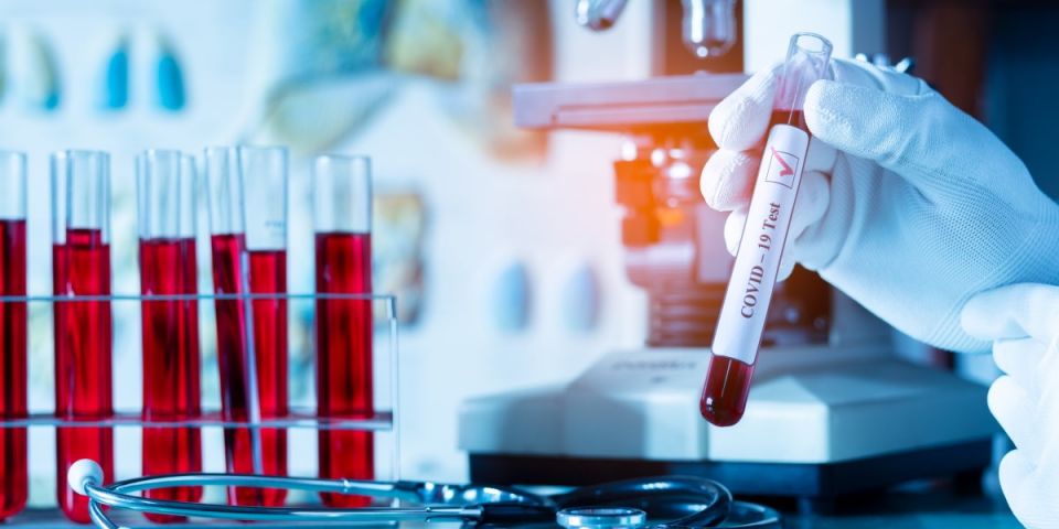 Coronavirus , World Health Association, CSIRO analysts, SARS-Cov-2, Dr Larry Marshall. , Virology Diary, covid, corona, coronavirus, covid-19 Coronavirus , World Health Association, CSIRO analysts, SARS-Cov-2, Dr Larry Marshall. , Virology Diary, covid, corona, coronavirus, covid-19