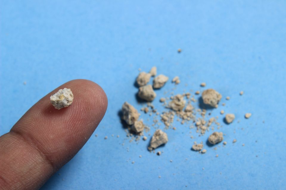 Dr Clare Bailey, Dr Michael, Eamonn Holmes: Sceptical As Specialist Discloses How To Lose A Stone In 21 Days., kidney, kidney stone Dr Clare Bailey, Dr Michael, Eamonn Holmes: Sceptical As Specialist Discloses How To Lose A Stone In 21 Days., kidney, kidney stone