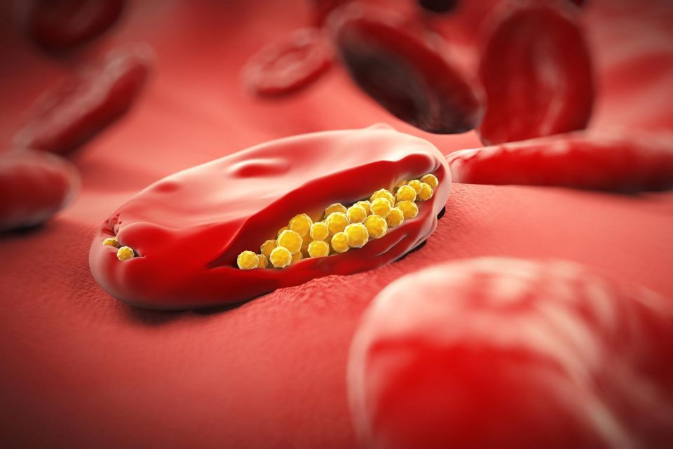 Which Tests Can Be Done to Confirm HIV Infection?, HIV Infection, Confirm HIV, Tests for HIV Infection