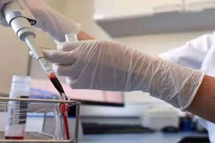 Delhi CM Kejriwal, plasma bank, Delhi, CM, Kejriwal, Plasma, donate plasma Delhi CM Kejriwal, plasma bank, Delhi, CM, Kejriwal, Plasma, donate plasma