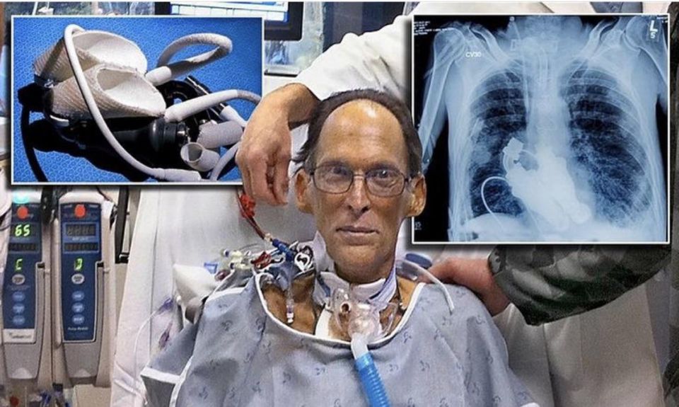 Hearbeat, Man, Dr Billy Cohn and Dr Bud Frazier, Mr Lewis's heart, Texas heart institute Hearbeat, Man, Dr Billy Cohn and Dr Bud Frazier, Mr Lewis's heart, Texas heart institute