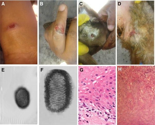 Orf viral infection , animal infection, Orf virus, viruses, Humans, sheep , goat