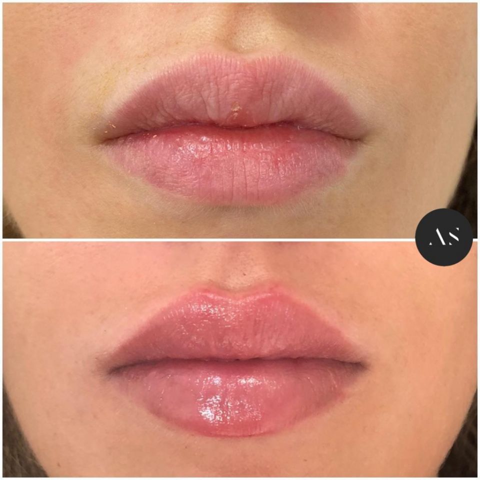 Dr Alejandro Segarra, artist, Facial Beauty By ‘Drawing On Smiles, Madrid is a medical artist Dr Alejandro Segarra, artist, Facial Beauty By ‘Drawing On Smiles, Madrid is a medical artist