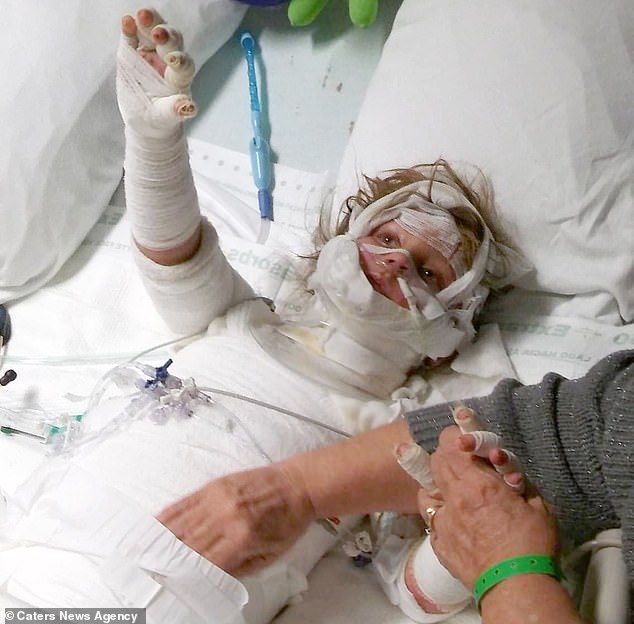 SJS, Disease, A boy, Stevens-Johnson Syndrome