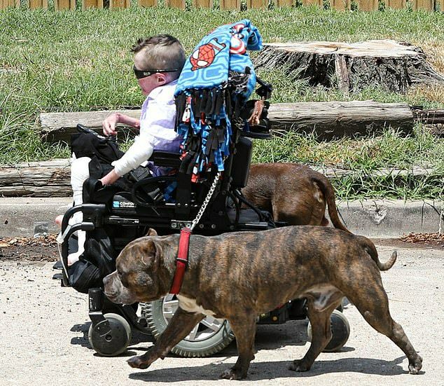 Butterfly Skin Disease, Born Different: This Little Boy Lived With The Butterfly Skin Disease., epidermolysis bullosa recessive tropical, worst disease, emotional support dogs