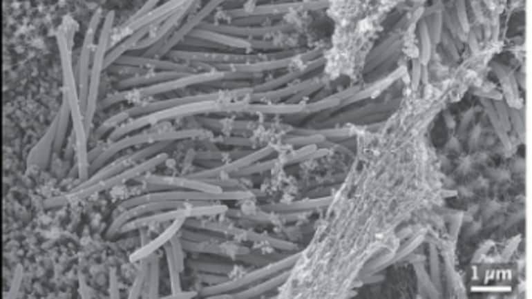 Covid-19,  SARS-CoV-2 , VIRUS, coronavirus, UNC, infection