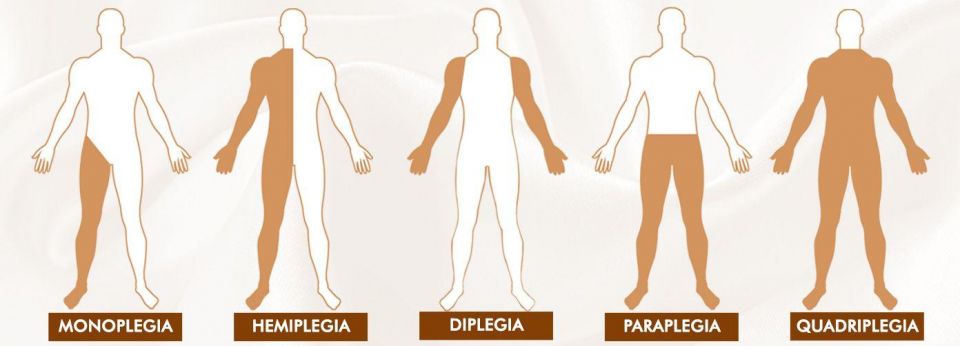 Paralysis, human body, human