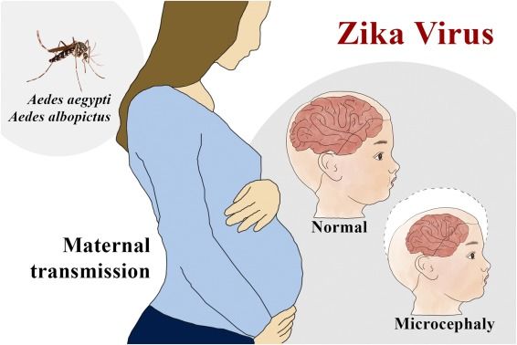 Zika Virus, zika, Neuroscientist, Brazil
