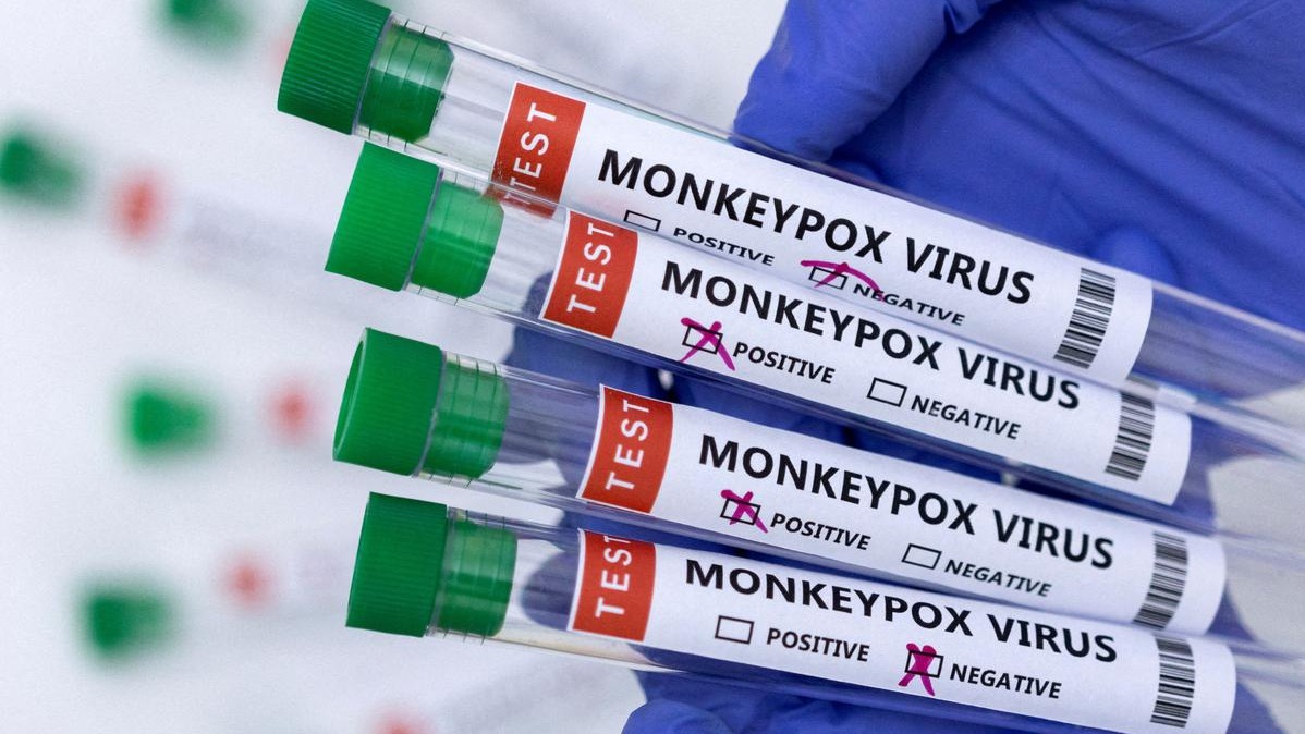 Monkeypox,  WHO,  United Kingdom,  Monkeypox pandemic,  Portugal