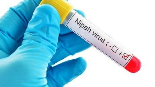 VIRUS, Nipah Virus