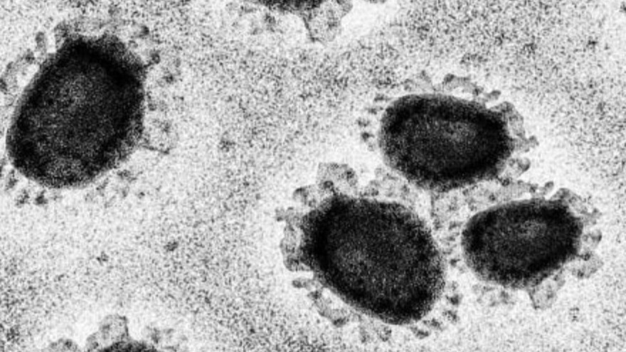 SARS-Cov-2, Francois Balloux, SARS COV2, Covid19, Corona