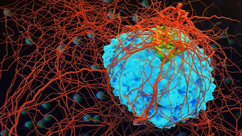 neoplastic cells,  fluorescently, chromosomes, stellar microtubules, dynamic tubule structure, supermolecule (EB1)