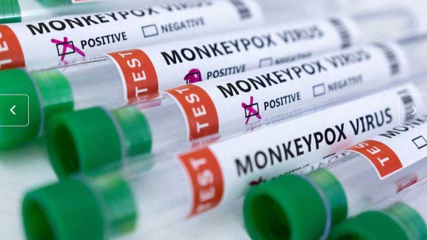 Monkeypox: WHO declares global emergency over