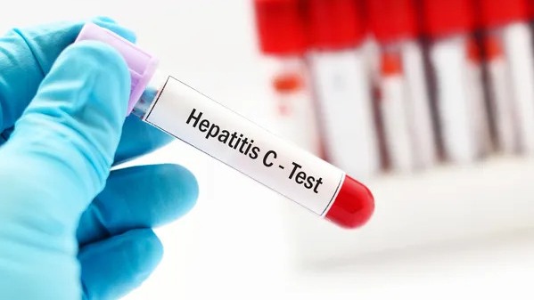 Hepatitis C home test kits available to most-at-risk in England
