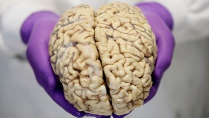 human body, brain, brain tissue, oxygen, blood