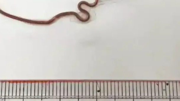 Pseudoterranova Hazaras, black moving worm