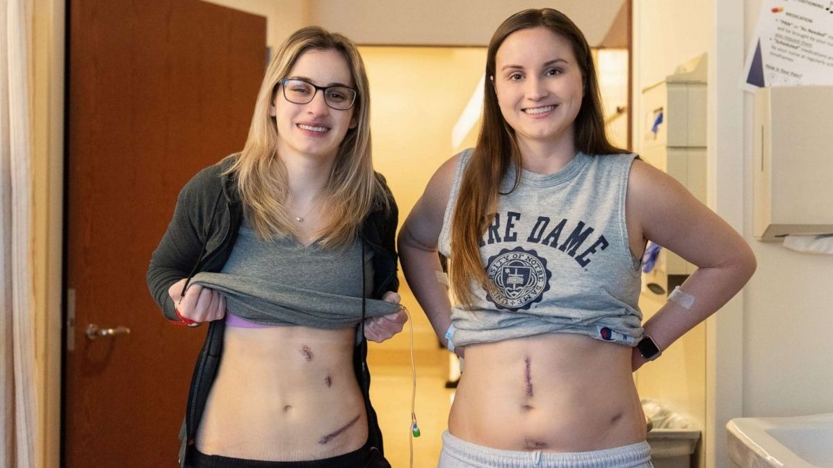 Two sister, kidney trasplant