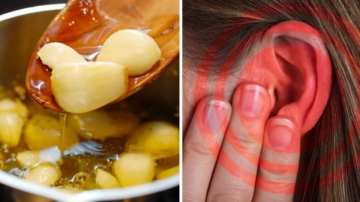 Garlic Can Be Applied To Help Treat Ear Infections. Garlic Can Be Applied To Help Treat Ear Infections.
