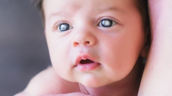 Peters' anomaly, disease, syndrome, eye, Peter's Anomaly: Disease That Cause Corneal Opacity., This is also a one type of the conditions., Peter's plus syndrome