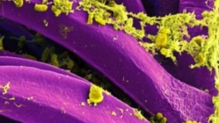 China, Mongolia, Bubonic plague, World Health Organization (WHO), Baotou city,  Inner Mongolia, China seals off town, world news, global news