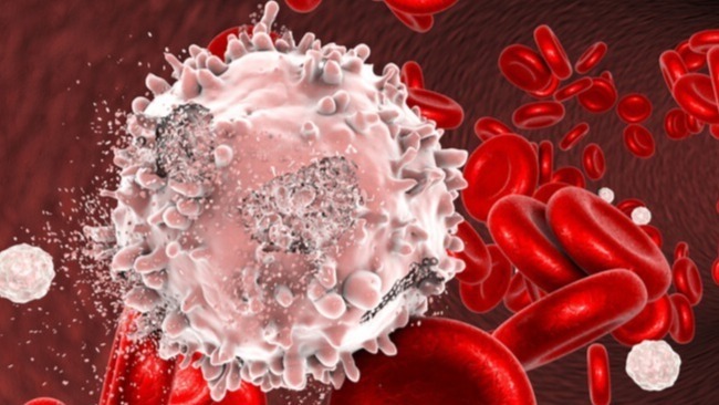 Acute myeloid leukemia, Blood cancer cell, FLT3, Quizartonib , leukaemia patients, Acute myeloid leukaemia, AML patients, blood cancer cell