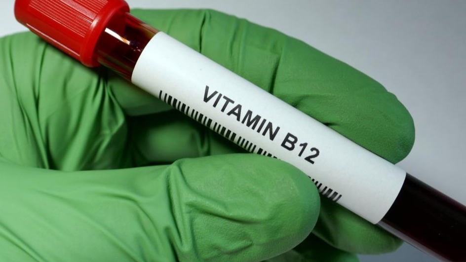 VITAMIN B12, symptoms, treatment, Body, Deficiency
