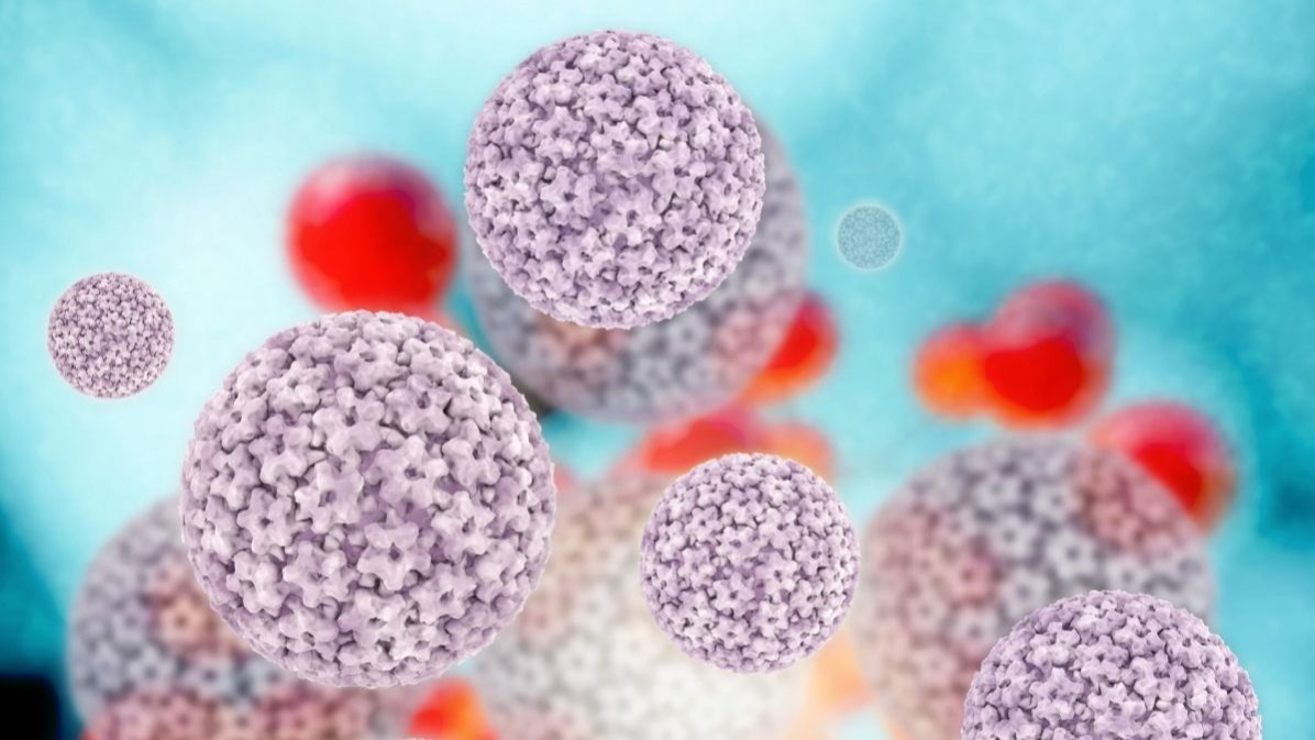 Anal cancer, disease, medical, health, treatment