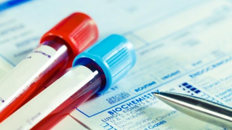 Erythrocyte anemia, hindrance, Stroke, Sickle cell , red blood cells