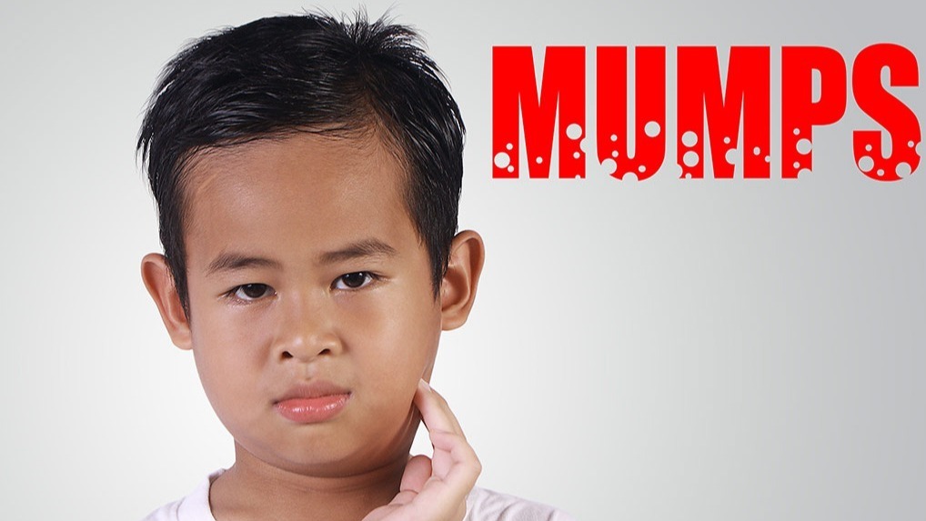 Mumps Virus, Testicles ,  saliva-producing glands,  salivary, epidemic parotitis