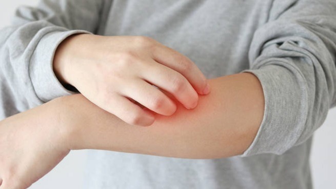 Rash , Infection, Health, human body, Giant Areas