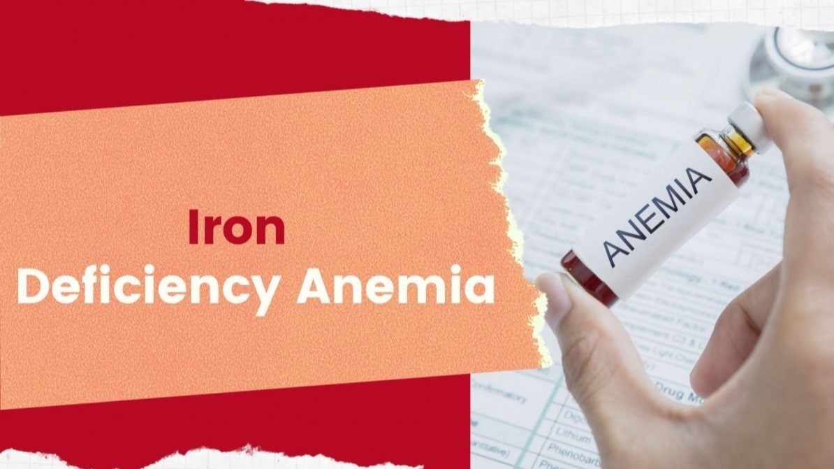 Iron deficiency anemia, Treat,  non-steroidal medicament medication , health, Iron