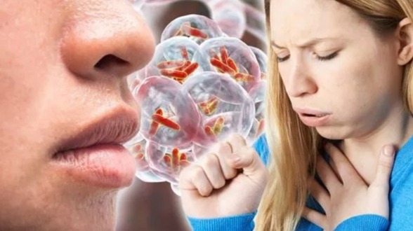 Whooping Cough, diseasse, human, health,  respiratory disorder, Children