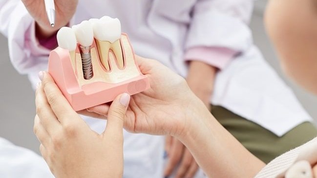 affordable dental implants in PCMC,  dental implants in PCMC,  affordable dental implants Pune,  dental implants Pimpri Chinchwad,  Dr Hileri Mori,  dental implant treatment PCMC,  affordable tooth replacement PCMC,  dental implant specialist PCMC,  dental implants Punawale,  missing teeth treatment PCMC