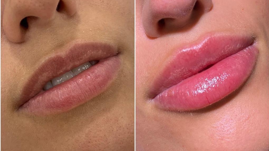 Dr Alejandro Segarra, artist, Facial Beauty By &lsquo;Drawing On Smiles, Madrid is a medical artist