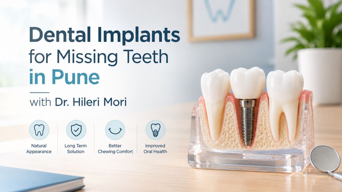 dental implants for missing teeth in Pune,  implants for missing teeth in Pune,  dental implants in Pune,  missing teeth replacement in Pune,  tooth replacement in Pune,  single tooth implant in Pune,  front tooth implant in Pune,  missing molar replacement,  multiple tooth implants in Pune,  implant supported bridge in Pune