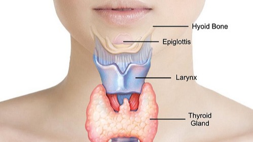 Hypothyroidism , health issue, hormonal issue , pin,  gained weight