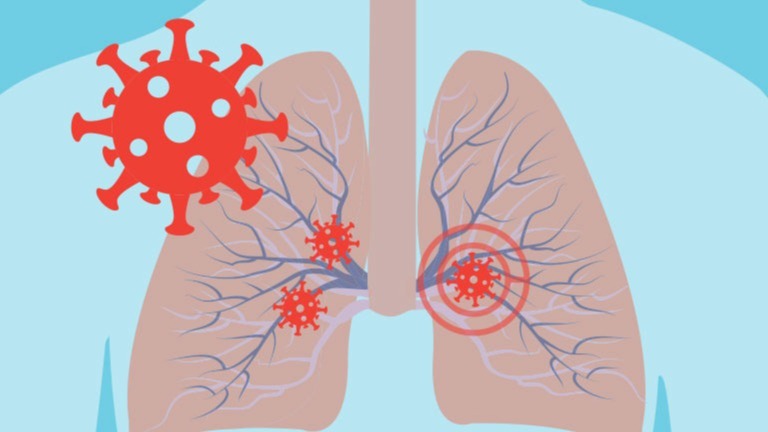 Netherlands, Scientists , lungs , health, covid-19, corona