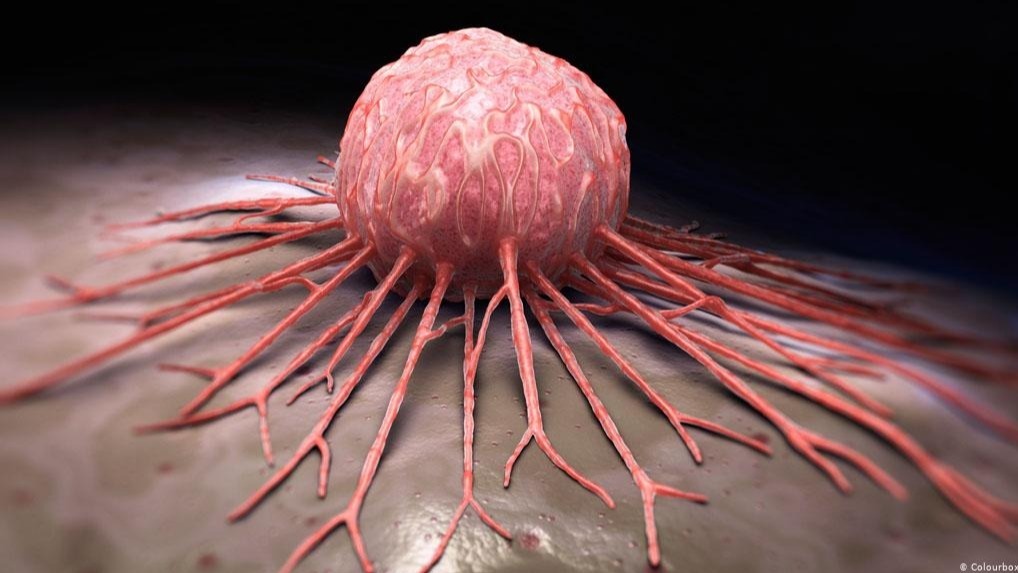 Breast cancer, carcinoma, Macromolecule, lungs, organ