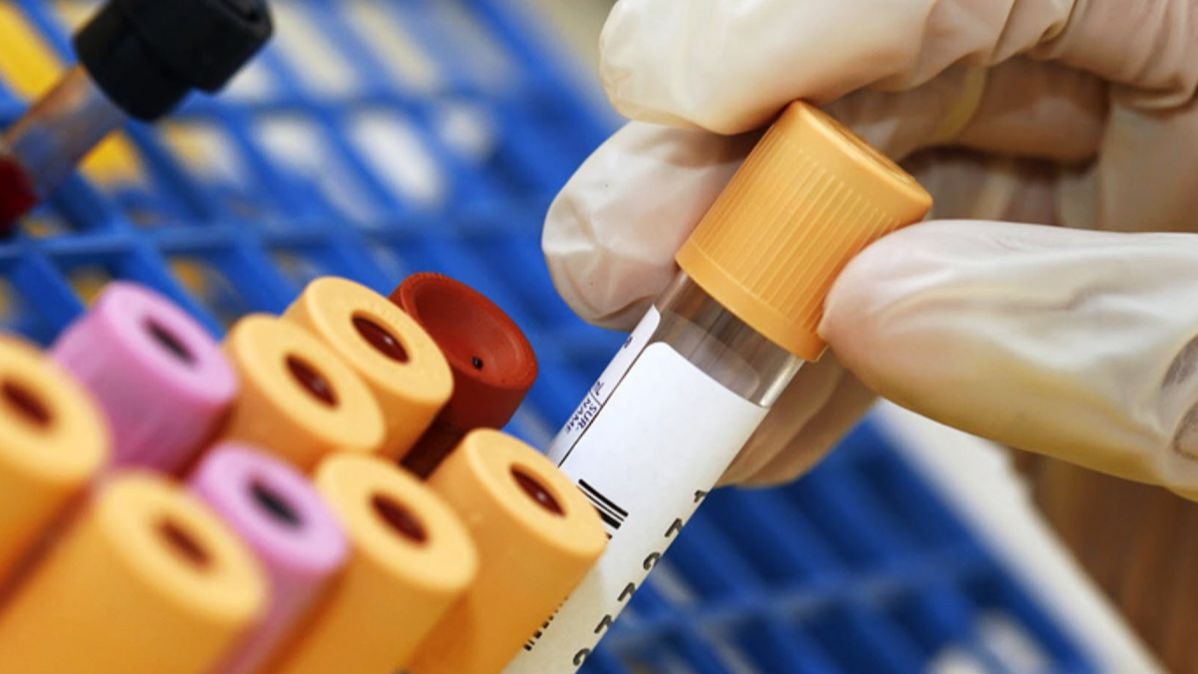 SARS-CoV-2 virus, COVID-19, Pandemic, Mystery Malady Cluster, Neurolysin