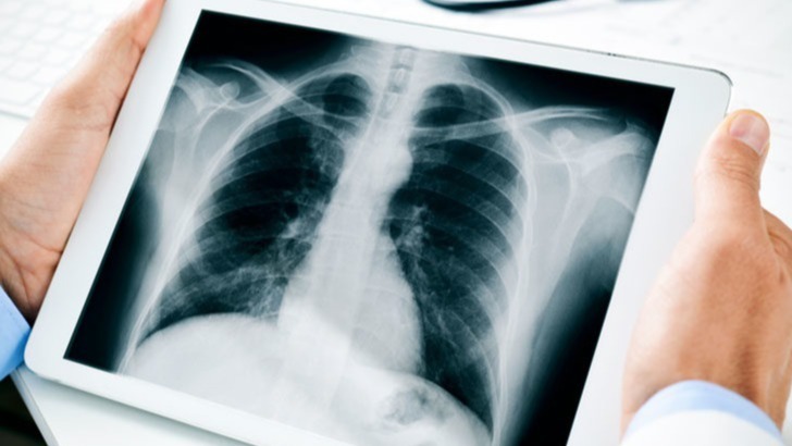 chimerical substance receptors (CAR-T), cancer, leukemia, Malignant Neoplastic Disease, Treatments