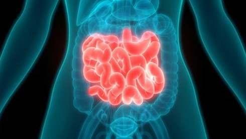 Carcinoid syndrome, Rare Diseases, tumor,  diagnose, Cancer