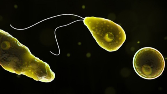 brain-eating amoeba, N. fowleri,  Infectious Diseases, brain infection,  Amoeba