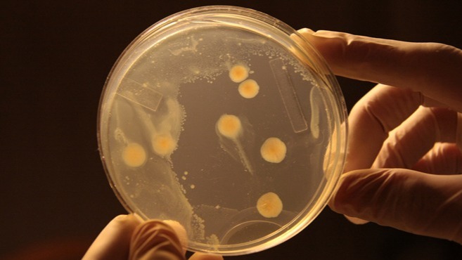 Bacteria, health , inflammatory , disorders, gut microbiome,  E.coli