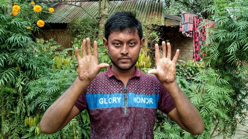 village, family, No fingerprints, Science, dermatoglyphics