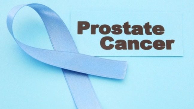Prostate cancer , Treatment ,  risk factors,  family history, Prostatic Adenocarcinoma, sign