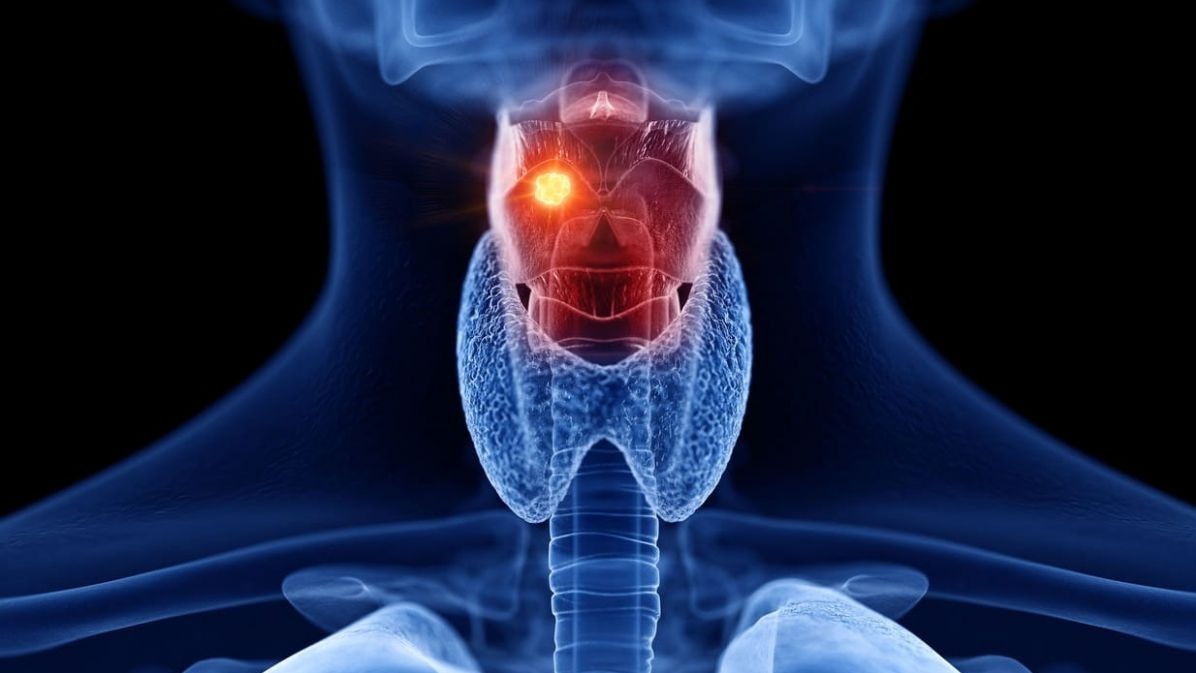 Oral Cavity And Cavum Cancer: Cancer Of The Pinnacle And Region.