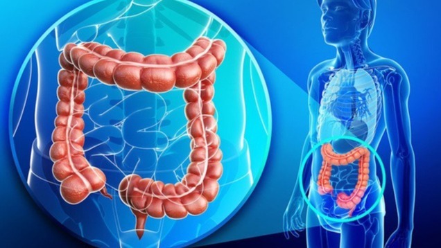 Food allergy,  hypersensitivity reaction, allergic reactions, IgE, symptoms